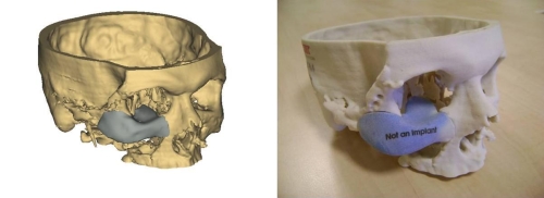 3d printed visual  medical objects